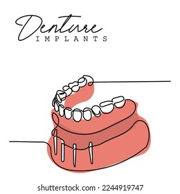 Continuous line art of Orthodontic treatment. Dentists day and respect for their services to humanity. Dental procedures vector art concept. Isolated vector of teeth and jaws. Retainers braces denture