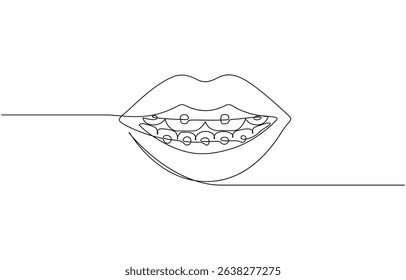Continuous line drawing of braces for teeth. Vector illustration as line art outline, One continuous drawing of dental aligners. Dental care. Vector illustration.