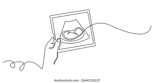 continuous line hand holding ultrasound photo of baby.scan photo of baby in womb.single line illustration.eps 10