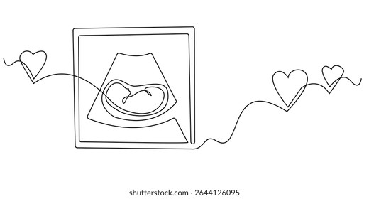 continuous line ultrasound photo of baby.scan photo of baby in the womb.single line illustration.eps 10