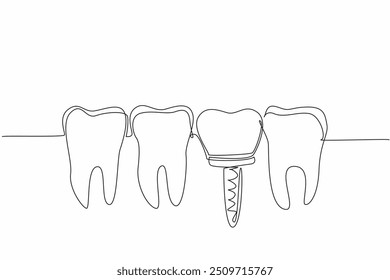 Continuous one line drawing teeth are aligned and one of them is an implant tooth. Do everything to prevent cavities. More caring. World Oral Health Day. Single line draw design vector illustration