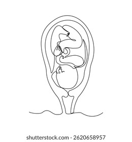 Continuous single line of baby fetus in mother womb. Human embryo with umbilical cord sketch drawing editable stroke vector illustration