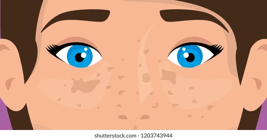 contour of eyes with spots on the skin