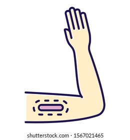 Contraceptive Implant Color Icon. Female Preservative Method. Unplanned Pregnancy Prevention, Birth Control With Medical Procedure. Underskin Input On Arm. Isolated Vector Illustration