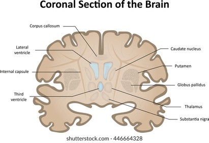 Coronal Section of the Brain
