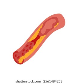 Coronary Artery Disease, Cardiovascular Disease Illustration Icon