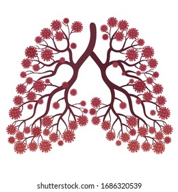 Coronavirus 2019-nCoV in human lungs vector illustration. Pneumonia. 