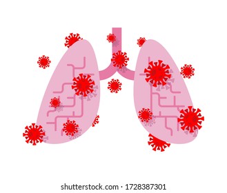 Coronavirus affected lungs. Diseased internal organ. Aching Viruses and bacteria. Human disease. Coronavirus epidemic in world. Outbreak Covid-19 Pandemic. World disaster