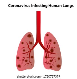 coronavirus affects human lungs vector design
