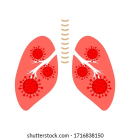 Coronavirus oder Bakterien im menschlichen Gepäck. Vektorillustration.