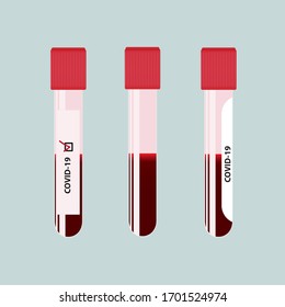 Tubos de análisis de sangre de Coronavirus. Ilustración vectorial.