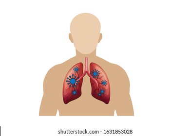 Coronavirus : CoV infographics element, Coronavirus attack on human lungs