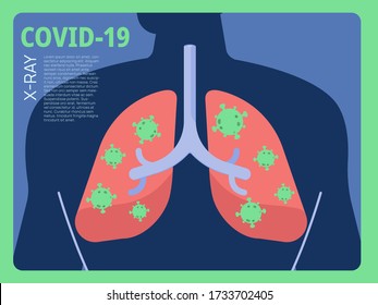 Coronavirus Covid-19 infographic showing x-ray image of human lungs infection and spreads of diseases. Concept of symptoms, health and medical in flat style.