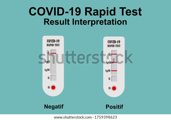 Stock vektor "Coronavirus Covid19 Ncov19 Testing Rapid Test" (bez...