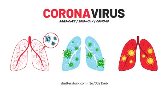 Coronavirus disease, corona virus in human lungs. Novel coronavirus outbreak (nCov-19, COVID-19). Human lungs with virus under microscope, elements for infographics. Vector