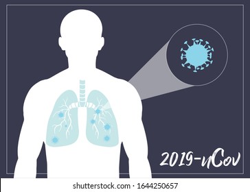 Coronavirus located in the human lung. Wuhan China, 2019 nCov. Vector lung.