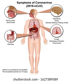 Coronavirus medical vector infographic, symptoms 