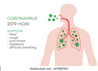 Coronavirus symptoms, 2019-nCoV. Human body with lungs affected by virus cells through the respiratory tract, by airborne droplets. Anatomy banner of Novel Coronavirus. Vector illustration.