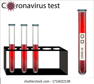  Prueba de coronavirus. Vector. Probar el virus de la gripe peligroso COVID-19 en el vial de sangre y en el kit de pruebas. Se puede utilizar en materiales médicos, carteles, carteles, revistas. Fondo blanco vectorial aislado.