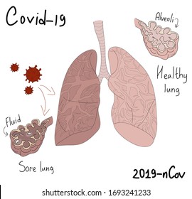 neumonía por coronovirus. pulmones humanos con enfermedades. dibujo a mano y letras a mano