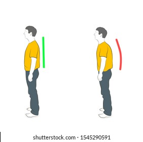 Correct alignment of human body in standing posture for good personality and healthy of spine and bone. Health care and medical illustration