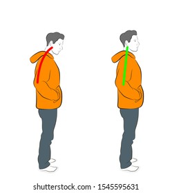 Correct alignment of human body in standing posture for good personality and healthy of spine and bone. Health care and medical illustration