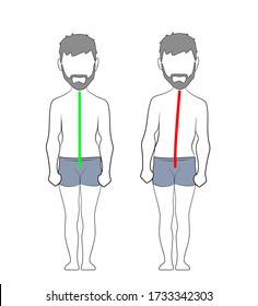 Correct alignment of human body in standing posture for good personality and healthy of spine and bone. Health care and medical illustration 