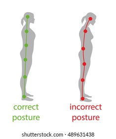 457 Incorrect standing posture Images, Stock Photos & Vectors ...