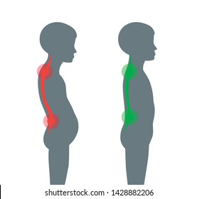 Correct alignment of kid body in standing posture for good personality and healthy of spine and bone. Health care and medical illustration 