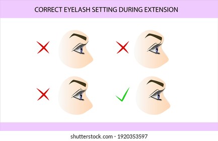 Correct application of artificial eyelashes to natural ones. Eyelash extension, guide, infographics, vector illustration