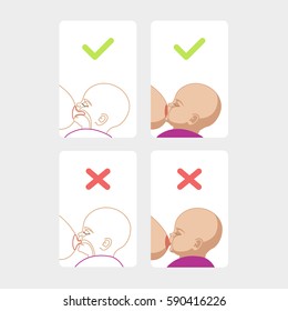 Correct breastfeeding position. Mother feeds baby with breast. Incorrect pose. Mom lactation infant milk.
