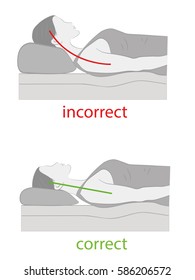 Correct And Incorrect Position Of The Head On The Pillow. Medical Recommendations Proper Sleep. Vector Illustration.