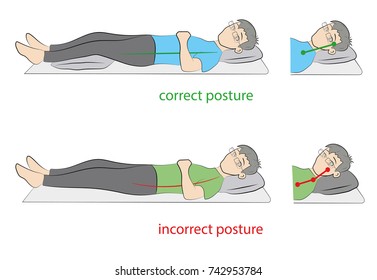 170 Posture collapse Images, Stock Photos & Vectors | Shutterstock