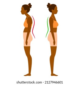 Correct and incorrect posture. Character, a young black woman with a stoop and a straight, even back. Flat vector illustration isolated on white background