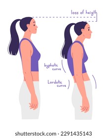 Correct and incorrect posture. The disadvantages of poor posture and the consequences of scoliosis