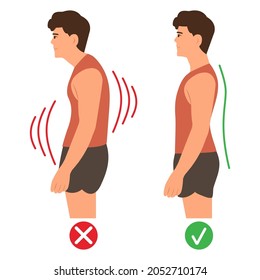 Correct and incorrect standing posture.Cervical spinal curvature. Hump. Healthy back.Vector illustration on white background. 