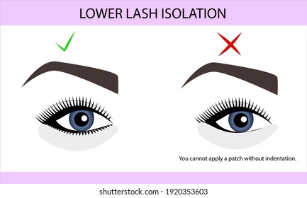 Correct isolation of lower eyelashes in upper eyelash extension, guide, infographics, vector illustration