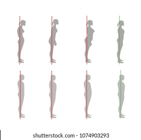 Correct And Not Correct Posture In Men And Women. Vector Illustration.