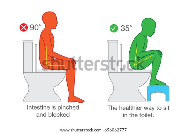 正しい座り方は 排泄を助けるために 便座上の体の適切な角度を得ます のベクター画像素材 ロイヤリティフリー