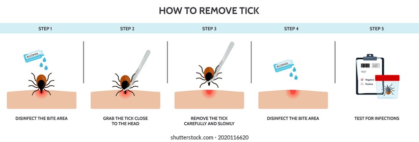 La forma correcta de eliminar correctamente un insecto de garrapatas. Prevención de infecciones transmitidas por ácaro