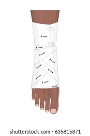 Correct way to wrap an ankle by flexible elastic supportive orthopedic bandage (sprain, strain). EPS 10