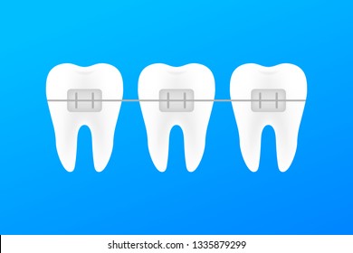 Correction of teeth with orthodontic braces. Stages of teeth alignment. Dental clinic services. Vector stock illustration.
