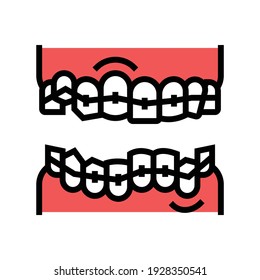 Korrekturzahnspangen-Farbsymbol-Vektorgrafik. Zahnkorrektur-Zahnspange-Schild. einzelne Symbolillustration