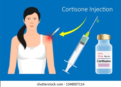 Cortisone Shots Injection Epidural Steroid ESI Lumbar Back Spinal Nerves Anti Inflammatory Carpal Tunnel Syndrome Tennis Elbow Symptom Swelling Chronic Discomfort