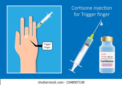 Cortisone Shots Injection Epidural Steroid ESI Lumbar Back Spinal Nerves Anti Inflammatory Carpal Tunnel Syndrome Tennis Elbow Symptom Swelling Chronic Discomfort