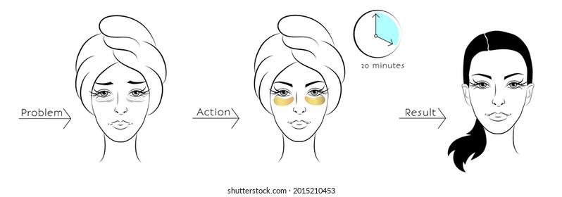 Cosmetic effect of eye patches. Skin problem and its solution with patches. A woman takes care of her skin. Linear vector illustration isolated on white background.