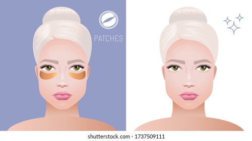 Cosmetic gold eye patches. Beautiful face of a woman with hydrogel gold patches under her eyes taking care of the skin. Express cosmetics. Vector realistic illustration.