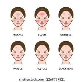 Cosmetic skin trouble_woman with freckle, blush, dryness, papule, pastule, blackhead