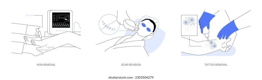 Conjunto de ilustraciones vectoriales de concepto abstracto de cirugía estética. Eliminación varicosa de la vena, revisión de cicatriz, eliminación del tatuaje láser, tratamiento de pigmentación, metáfora abstracta de flebectomía ambulatoria.