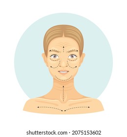 Cosmetic surgery on female face with dotted lines. Plastic surgery vector illustration